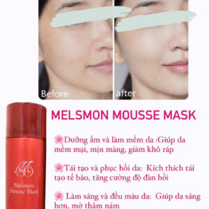 Melsmon Mousse Mask